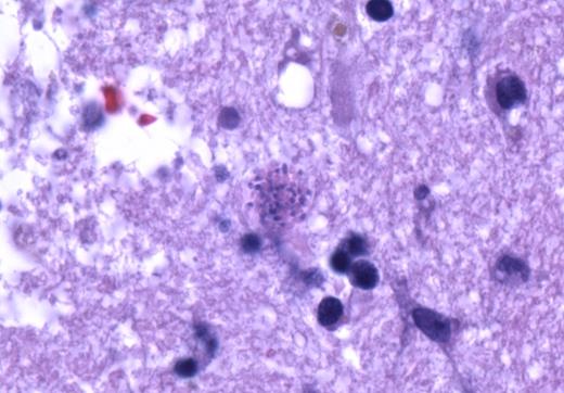 High-power image magnifying round structure seen to the left of the blood vessel in Figure 2.