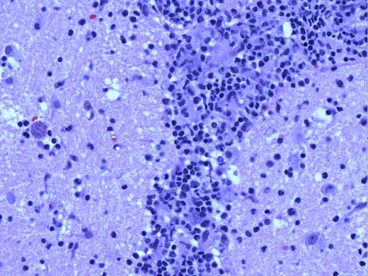 High-power image magnifying arrowed sections in Figure 2.