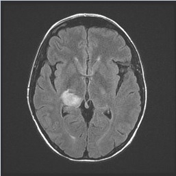 Representative brain imaging.