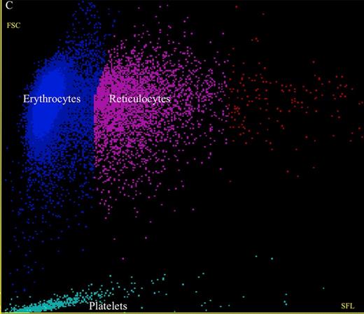 Figure showing review of reticulocyte scattergram. / Review of reticulocyte scattergram.