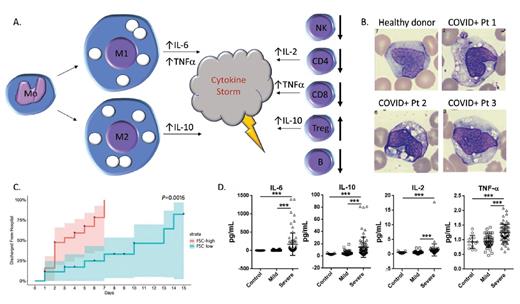 (A) Schematic of the abnormal production of circulating macrophages and monocytes as well as changes in T cell subsets in peripheral blood from patients with COVID-19. (B) Peripheral blood monocytes/macrophages from healthy donor (upper left) and three COVID-19-positive patients (images reprinted with permission from Zhang D et al. MedRxiv preprint; doi: 10.1101/2020.03.24.20042655). (C) Time to hospital discharge of patients with COVID-19 who were stratified by levels of forward scatter in monocytes (reprinted with permission from Zhang D et al). (D) Comparison of IL-6, IL-10, IL-2, and tumor necrosis factor a levels in healthy controls and COVID-19-positive patients with mild versus severe disease; ***, p<0.001 (reprinted with permission from Shi Y et al. MedRxiv preprint; doi: 10.1101/2020.03.12.20034736).