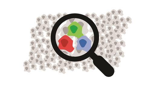 Midostaurin plus chemotherapy is standard of care inFLT3-ITD AML for young patients who can tolerate intensive chemotherapy. Resistance to this combination occurs in three distinct patterns: 1) acquired mutations in separate signaling pathways in a FLT3-ITD–negative clone, 2) selection of resistant subclones that express an FLT3 mutation, or 3) persistence of the dominant FLT3-ITD clone.