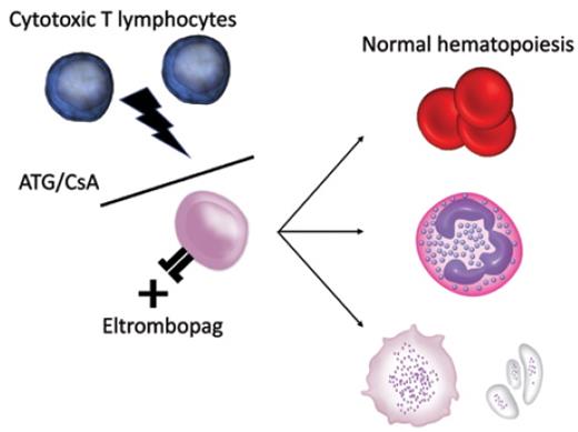 Combination treatment for severe aplastic anemia improves responses by preventing cytotoxic T-lymphocyte–mediated attack on hematopoietic stem cells and boosting stem cell function through thrombopoietin growth factor signaling. ATG/CsA, anti-thymocyte globulin/cyclosporine.