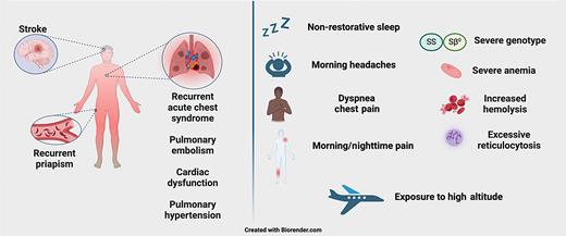 When to consider hypoxemia testing? Clinical factors that increase suspicion for occult hypoxemia in people with sickle cell disease