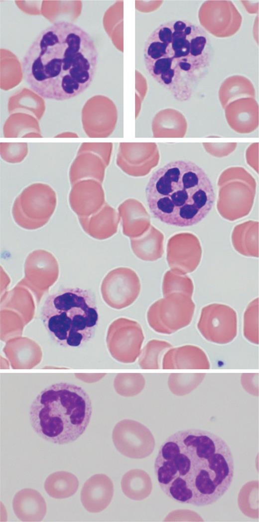 Top and middle row are from the same patient. Bottom row is from a different patient.