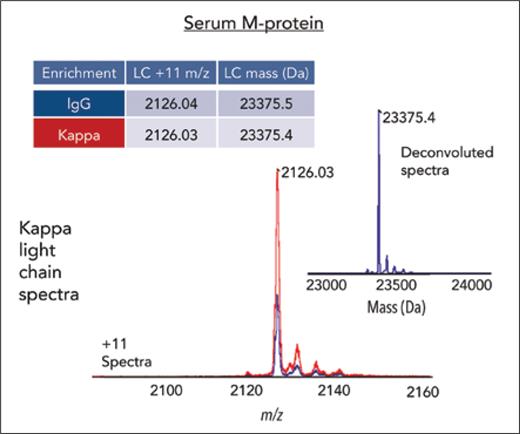 Kappa light chain of patient’s monoclonal gammopathy of undetermined significance antibody7