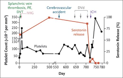 Normalization of platelet counts and heparin-induced thrombocytopenia testing results in a patient with MGTS treated with daratumumab, bortezomib, and dexamethasone8