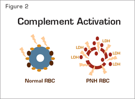 Complement Activation. Normal erythrocytes (left) are protected against complement-mediated lysis primarily by CD55 (brown circles) and CD59 (gold circles). Deficiency of these GPI-anchored complement regulatory proteins results in APC activation on PNH erythrocytes (right). Consequently, MACs form pores in the red cell membrane resulting in osmotic lysis and release of hemoglobin and LDH into the intravascular space.