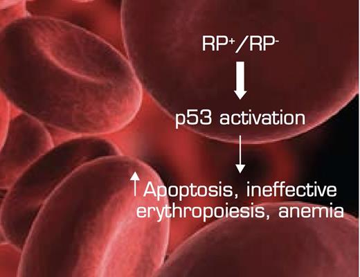 The Convergence of Bone Marrow Failure Syndromes Such as del (5q) MDS and DBA, Ribosomal Protein (RP) Haploinsufficiency, and Induction of p53. In this model, reduced RP gene dosage triggers stabilization/activation of the p53 pathway in the erythroid department, resulting in increased apoptosis and ineffective erythropoiesis/anemia. Figure adapted from McGowan KA, Li JZ, Park CY, et al. Ribosomal mutations cause p53-mediated dark skin and pleiotropic effects. Nat Genet. 2008; 40:963-70. (Figure 7)