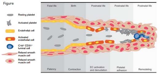 The Role of Platelets for Sealing of the Contracted DA. The scheme delineates the proposed sequence of events contributing to postnatal DA occlusion, which ultimately leads to permanent DA closure. As a result, the luminal aspect of the DA wall adopts a prothrombotic phenotype with endothelial activation, deposition of vWF and fibrin(ogen), and eventually endothelial cell detachment from the internal elastic lamina, leading to the collagen exposure. Together, this triggers the accumulation of platelets circulating in the residual DA lumen. The platelet plug that forms seals the residual lumen of the contracted DA and, together with other mechanisms, facilitates subsequent luminal remodeling.
