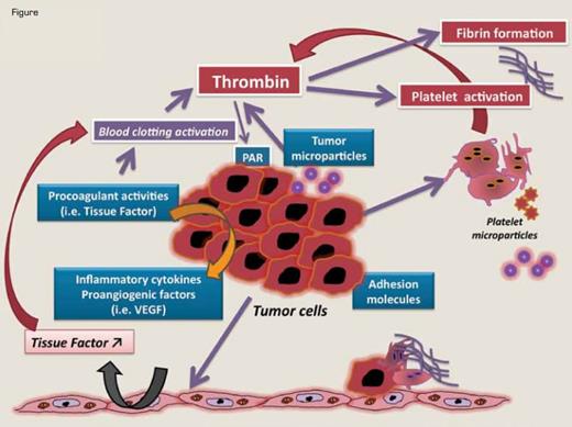 Mechanisms of Hemostatic System Activation by Tumor Cells Involves Different Hemostatic Pathways. Tumor cells produce procoagulant, fibrinolytic, and platelet-aggregating activities and release proinflammatory and proangiogenic cytokines and procoagulant microparticles. Tumor cells interact with host vascular and blood cells (i.e., platelets, leukocytes, and endothelial cells) by means of direct adhesion, which activates the prothrombotic properties of these cells. Tumor cell-derived TF plays a central role in the generation of thrombin, but TF can also contribute to tumor growth and metastasis by coagulation-independent mechanisms, including influencing the expression of VEGF by the malignant cells and vascular cells and activating the PAR-2 signaling.The generation of activated coagulation proteases (FVIIa, FXa, thrombin) and the formation of fibrin represent coagulation-dependent mechanisms of tumor progression, as they promote neo-angiogenesis and tumor proliferation. Fibrin coats also protect circulating cancer cells from attack by the host immune system.