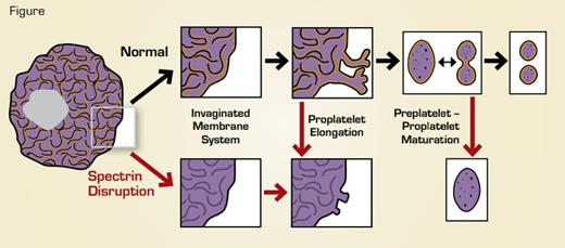 . / Disruption (red arrows) of spectrin tetramers disrupts multiple stages of megakaryocyte maturation and platelet formation. After disruption, megakaryocytes fail to form a normal invaginated membrane system, proplatelets that started to elongate retract, and proplatelet “barbells” lose their structure and fail to form platelets. Yellow indicates supporting spectrin skeleton.