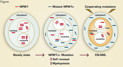Secondary Leukemogenic Mutations May Involve Alterations of Proliferation Signals, Transcription Factors, Other Signaling Molecules, and/or Tumor Suppressors.