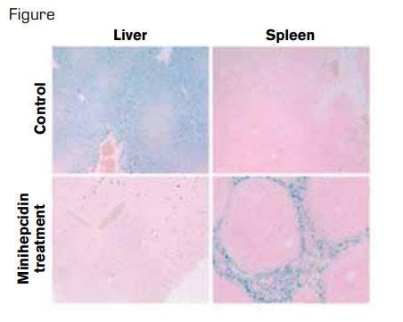 Minihepcidin Treatment Prevents Hemochromatosis Phenotype in Hepcidin Knockout Mice. In hereditary hemochromatosis, because of hepcidin deficiency, iron is excessively exported into plasma, both from enterocytes, which absorb dietary iron and from macrophages, which recycle iron from old red blood cells. This process results in iron overload of hepatocytes in the liver and iron-deficient spleen macrophages, as shown in the top row of the figure for knockout mice treated with solvent only. In the bottom row, two weeks of daily minihepcidin injections prevented liver iron accumulation and caused normalization of iron stores in spleen macrophages.