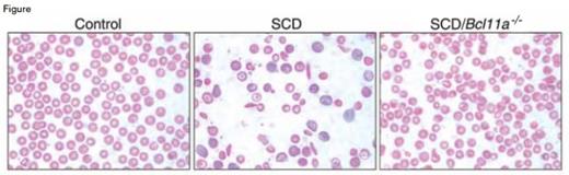 Sickled Red Cells Were Absent in SCD/Bcl11a-/- Mice. From Xu et al. Science 334:6058 (18 Nov 2011). Reprinted with permission from AAAS.